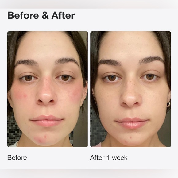 Slushy - INNBEAUTY Project
Serum Moisturizer 2N1
1.7 oz BRAND NEW - Picture 8 of 16